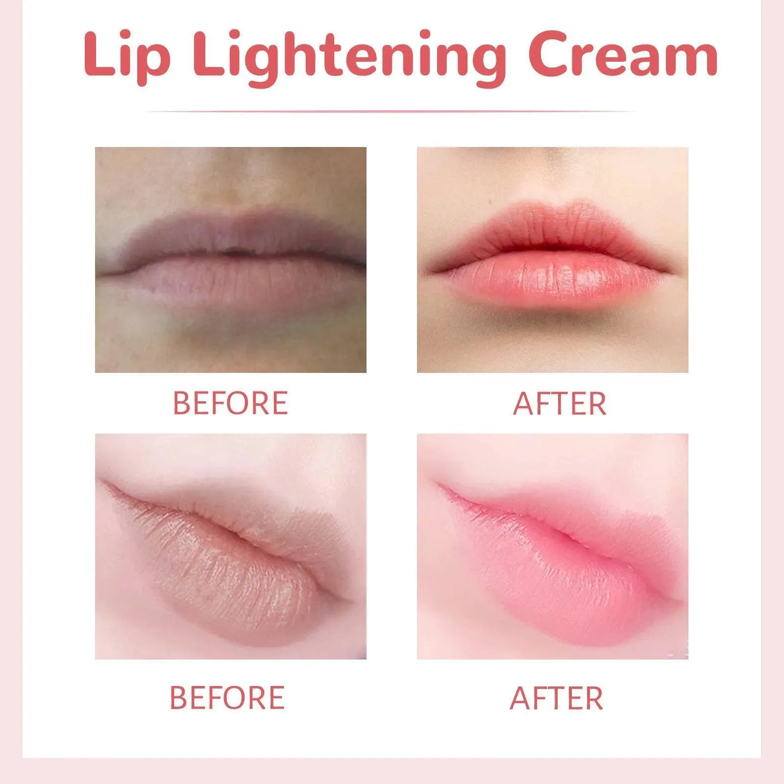 Eelhoe Lip Lightening Cream - 30g